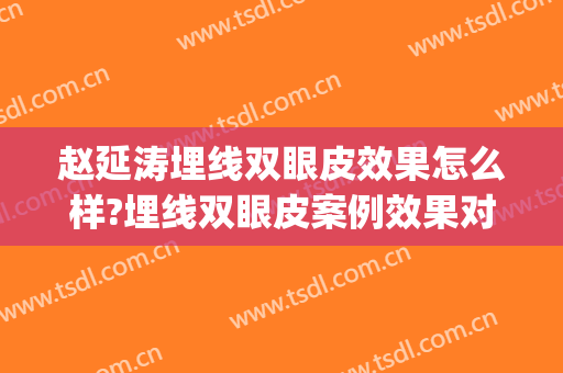 赵延涛埋线双眼皮效果怎么样?埋线双眼皮案例效果对比图_河北医科大学第一医院