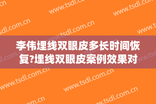 李伟埋线双眼皮多长时间恢复?埋线双眼皮案例效果对比图_重庆市急救医疗中心