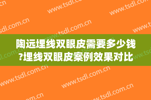 陶远埋线双眼皮需要多少钱?埋线双眼皮案例效果对比图_济南市第二人民医院