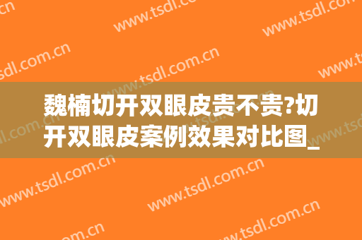 魏楠切开双眼皮贵不贵?切开双眼皮案例效果对比图_天津医科大学眼科医院