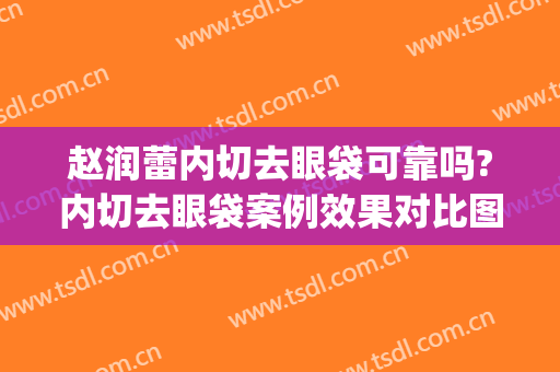 赵润蕾内切去眼袋可靠吗?内切去眼袋案例效果对比图_北京大学第三医院
