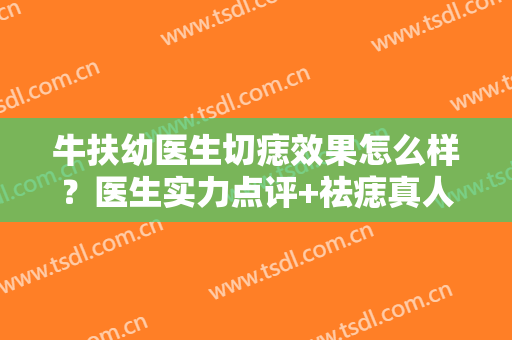 牛扶幼医生切痣效果怎么样？医生实力点评+祛痣真人案例分享