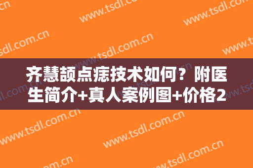 齐慧颉点痣技术如何？附医生简介+真人案例图+价格2024