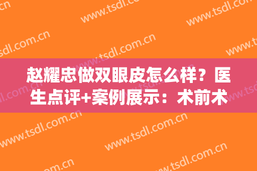 赵耀忠做双眼皮怎么样？医生点评+案例展示：术前术后差别一看就知~(赵忠芳双眼皮)