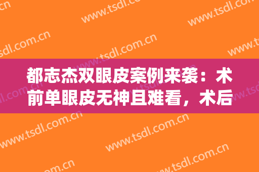 都志杰双眼皮案例来袭：术前单眼皮无神且难看，术后变身美眼女神(梁志为双眼皮案例)