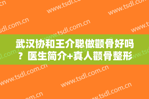 武汉协和王介聪做颧骨好吗？医生简介+真人颧骨整形案例分享