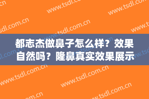都志杰做鼻子怎么样？效果自然吗？隆鼻真实效果展示(王志坚做鼻子怎么样)