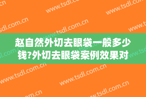 赵自然外切去眼袋一般多少钱?外切去眼袋案例效果对比图_吉林大学第一医院二部