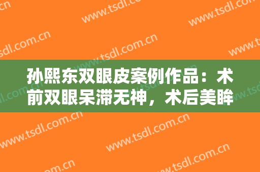 孙熙东双眼皮案例作品：术前双眼呆滞无神，术后美眸超有神！