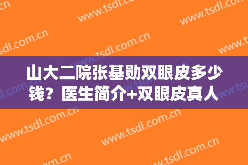山大二院张基勋双眼皮多少钱？医生简介+双眼皮真人案例+价格表(山大医院割双眼皮价格)