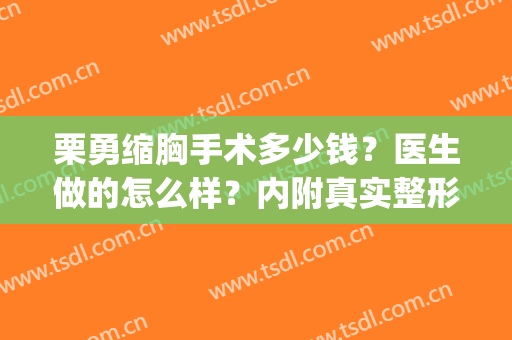 栗勇缩胸手术多少钱？医生做的怎么样？内附真实整形案例！(美莱栗勇缩胸多少钱)