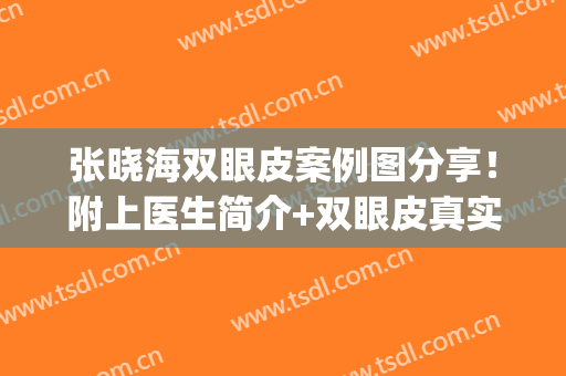 张晓海双眼皮案例图分享！附上医生简介+双眼皮真实手术记录(北京张海明双眼皮修复案例)