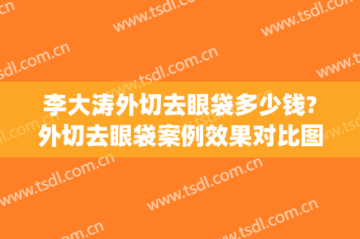 李大涛外切去眼袋多少钱?外切去眼袋案例效果对比图_上海交通大学医学院附属第九人民医院