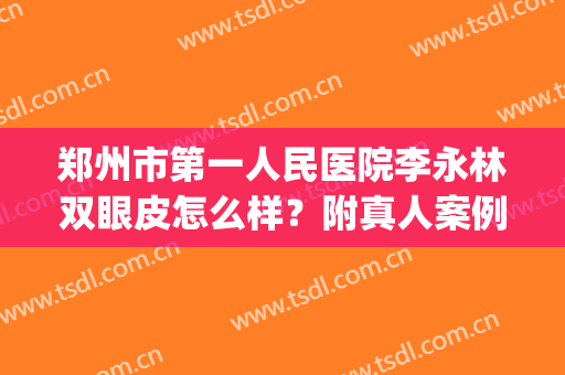 郑州市第一人民医院李永林双眼皮怎么样？附真人案例图赏析(郑州市第一人民医院割双眼皮)