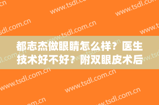 都志杰做眼睛怎么样？医生技术好不好？附双眼皮术后效果(时杰做双眼皮好吗)