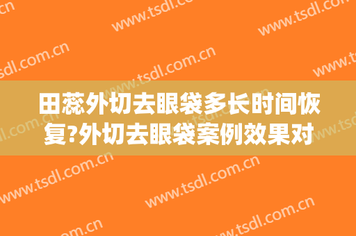 田蕊外切去眼袋多长时间恢复?外切去眼袋案例效果对比图_吉林大学第二医院