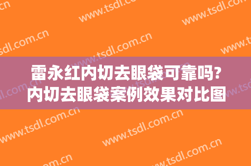 雷永红内切去眼袋可靠吗?内切去眼袋案例效果对比图_中国人民解放军总医院第一医学中心