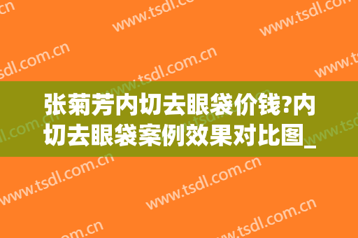 张菊芳内切去眼袋价钱?内切去眼袋案例效果对比图_杭州市第一人民医院