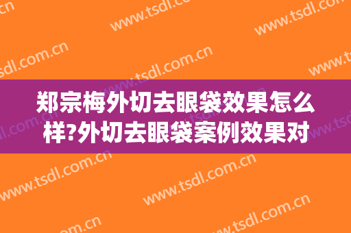 郑宗梅外切去眼袋效果怎么样?外切去眼袋案例效果对比图_首都医科大学附属北京口腔医院