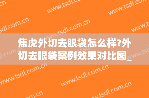 焦虎外切去眼袋怎么样?外切去眼袋案例效果对比图_中国医学科学院整形外科医院