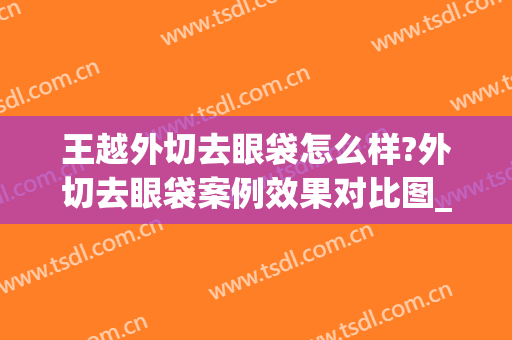 王越外切去眼袋怎么样?外切去眼袋案例效果对比图_首都医科大学附属北京同仁医院