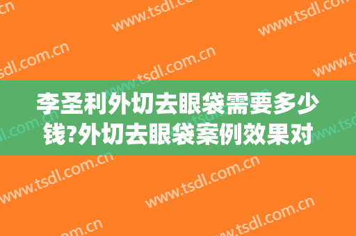 李圣利外切去眼袋需要多少钱?外切去眼袋案例效果对比图_上海交通大学医学院附属第九人民医院