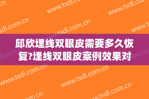 邱欣埋线双眼皮需要多久恢复?埋线双眼皮案例效果对比图_成都八大处医疗美容医院