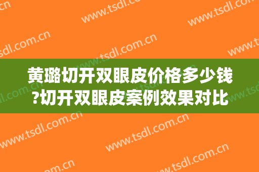 黄璐切开双眼皮价格多少钱?切开双眼皮案例效果对比图_台州市中心医院