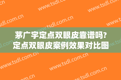 茅广宇定点双眼皮靠谱吗?定点双眼皮案例效果对比图_上海市第六人民医院
