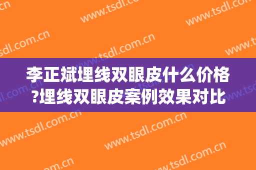李正斌埋线双眼皮什么价格?埋线双眼皮案例效果对比图_郑州人民医院