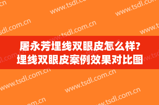 屠永芳埋线双眼皮怎么样?埋线双眼皮案例效果对比图_安阳市眼科医院