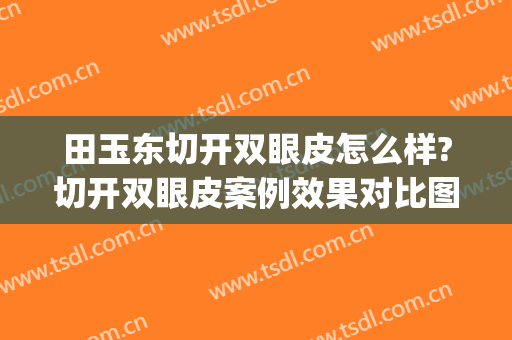 田玉东切开双眼皮怎么样?切开双眼皮案例效果对比图_济南市第一人民医院