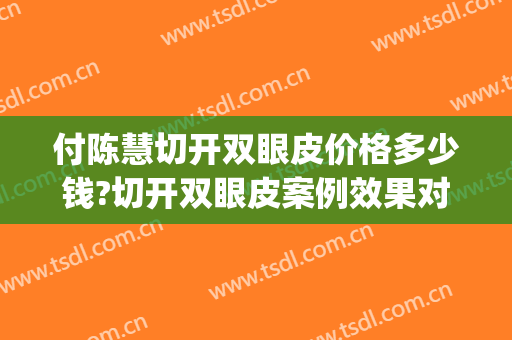 付陈慧切开双眼皮价格多少钱?切开双眼皮案例效果对比图_长江航运总医院
