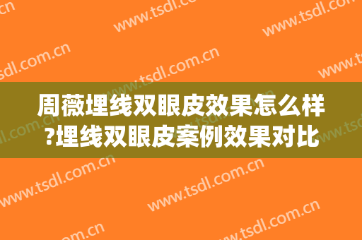 周薇埋线双眼皮效果怎么样?埋线双眼皮案例效果对比图_上海伯思立医疗美容门诊部