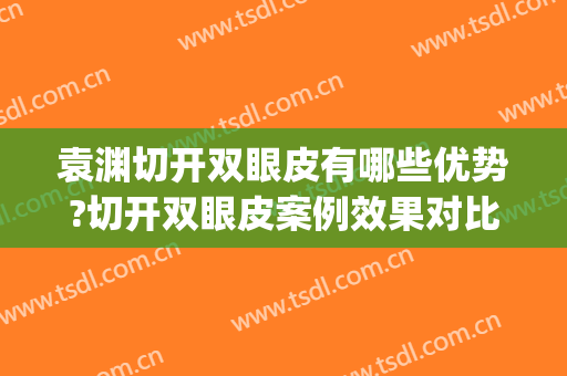 袁渊切开双眼皮有哪些优势?切开双眼皮案例效果对比图_好大夫工作室