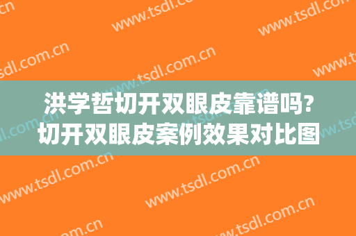 洪学哲切开双眼皮靠谱吗?切开双眼皮案例效果对比图_西安医学院第二附属医院