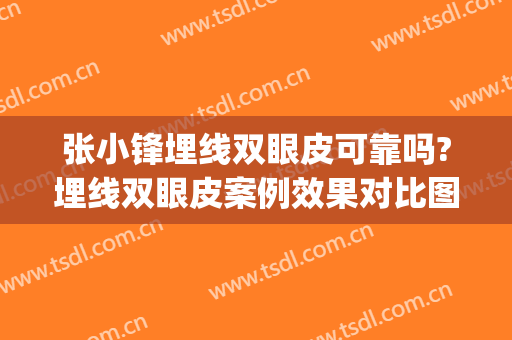 张小锋埋线双眼皮可靠吗?埋线双眼皮案例效果对比图_汉中市中心医院