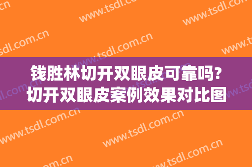 钱胜林切开双眼皮可靠吗?切开双眼皮案例效果对比图_广州市第一人民医院