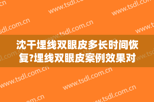 沈干埋线双眼皮多长时间恢复?埋线双眼皮案例效果对比图_南京医科大学第二附属医院