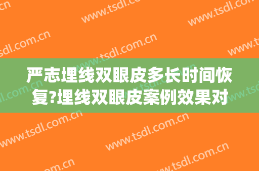 严志埋线双眼皮多长时间恢复?埋线双眼皮案例效果对比图_武汉市中西医结合医院