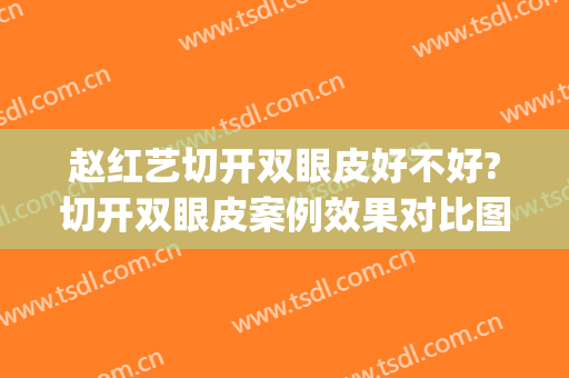 赵红艺切开双眼皮好不好?切开双眼皮案例效果对比图_北京医院(赵佳丽双眼皮是割的吗)