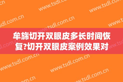 牟旆切开双眼皮多长时间恢复?切开双眼皮案例效果对比图_上海长征医院