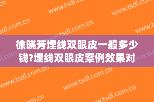 徐晓芳埋线双眼皮一般多少钱?埋线双眼皮案例效果对比图_上海交通大学医学院附属第九人民医院
