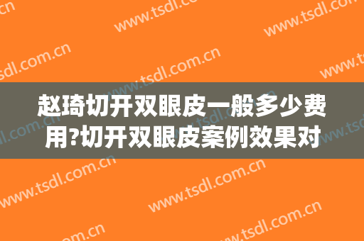 赵琦切开双眼皮一般多少费用?切开双眼皮案例效果对比图_山东大学齐鲁医院