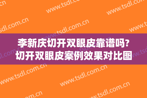 李新庆切开双眼皮靠谱吗?切开双眼皮案例效果对比图_南京医科大学附属常州第二人民医院
