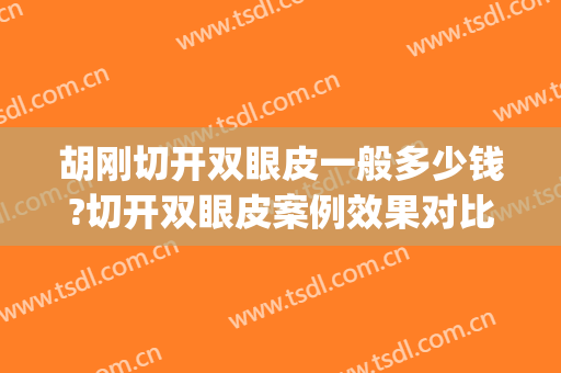 胡刚切开双眼皮一般多少钱?切开双眼皮案例效果对比图_大连医科大学附属第一医院