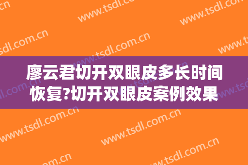 廖云君切开双眼皮多长时间恢复?切开双眼皮案例效果对比图_南方医科大学南方医院