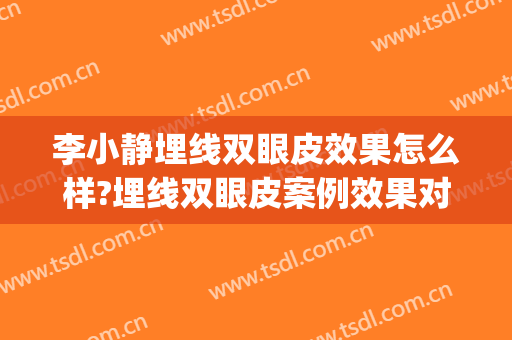 李小静埋线双眼皮效果怎么样?埋线双眼皮案例效果对比图_安徽医科大学第一附属医院