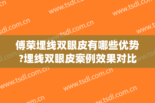 傅荣埋线双眼皮有哪些优势?埋线双眼皮案例效果对比图_四川省医学科学院·四川省人民医院