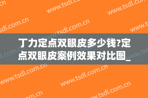 丁力定点双眼皮多少钱?定点双眼皮案例效果对比图_福建省立医院(三维定点双眼皮)